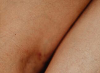 The Role Of Art Therapy In Trauma Recovery: Unlock Healing Power